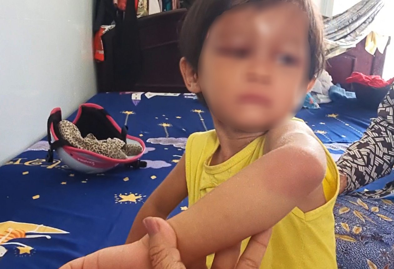 Vụ bé gái 4 tuổi bị cha nuôi đánh đập ở Cà Mau: Bắt tạm gia người cha - Ảnh 1.