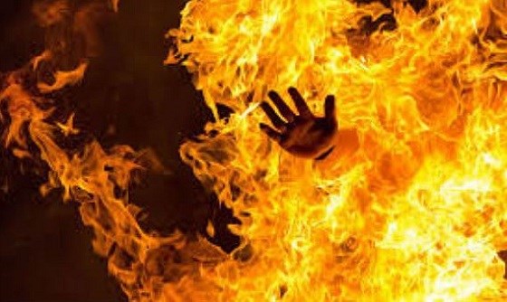 Tây Ninh: Nghi vấn chồng say xỉn, tẩm xăng phóng hỏa đốt vợ gây bỏng nặng sau khi cãi nhau - Ảnh 1.