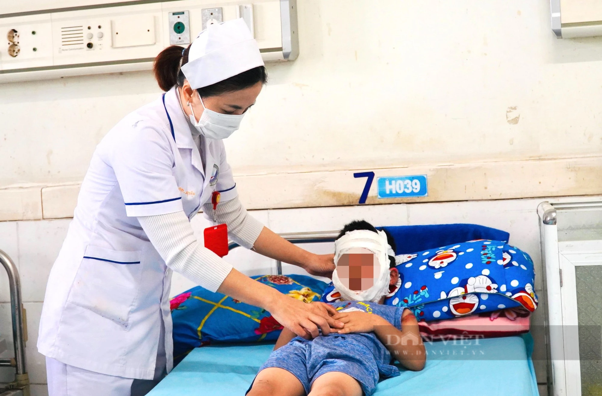 Bóng bay phát nổ, bé trai 4 tuổi ở Quảng Nam bỏng hết khuôn mặt - Ảnh 2.