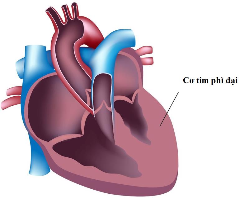 Định Áp Vương - Giải pháp cho người huyết áp cao, huyết áp không ổn định - Ảnh 2.