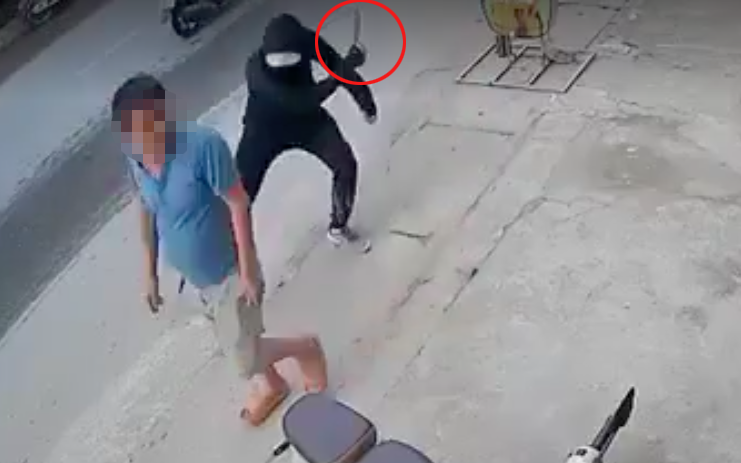 Diễn biến mới vụ người đàn ông bị chém lìa chân khi đi bộ ở Hà Nội