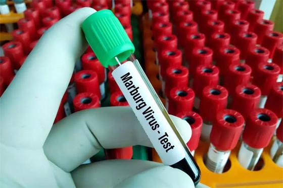 TP.HCM cảnh giác với virus gây chết người tại Trung Phi - Ảnh 1.