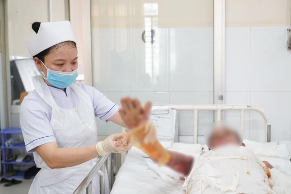 Kỷ niệm Ngày Thầy thuốc Việt Nam 27/2: Không chỉ vá lành những vết bỏng trên da thịt - Ảnh 4.