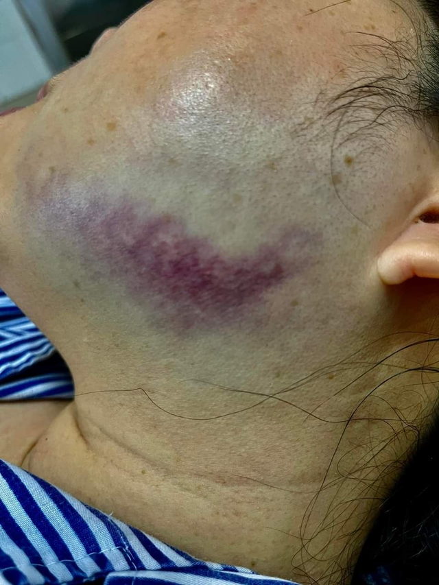 Vụ nữ trưởng văn phòng công chứng bị đá tím mặt: Đã có kết quả giám định pháp y - Ảnh 2.