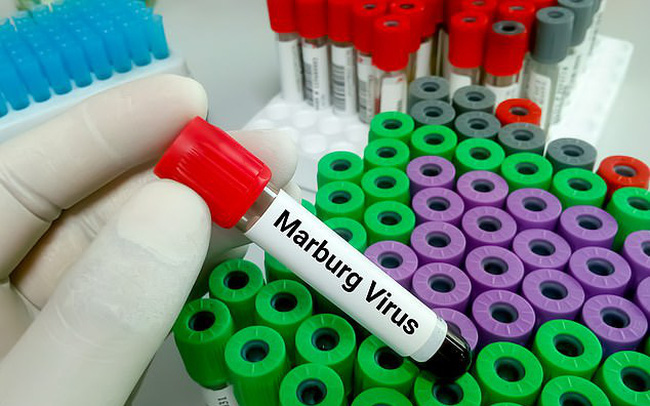 TP.HCM: Tăng cường cảnh giác với virus Marburg - Ảnh 1.