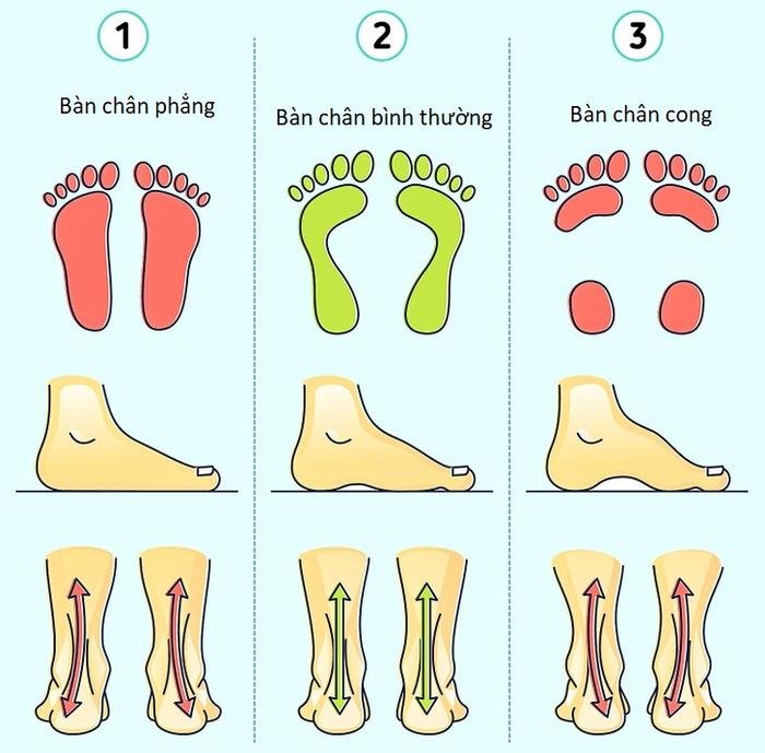 Sai lầm khi mua giày dép khiến chân đau đớn - Ảnh 2.