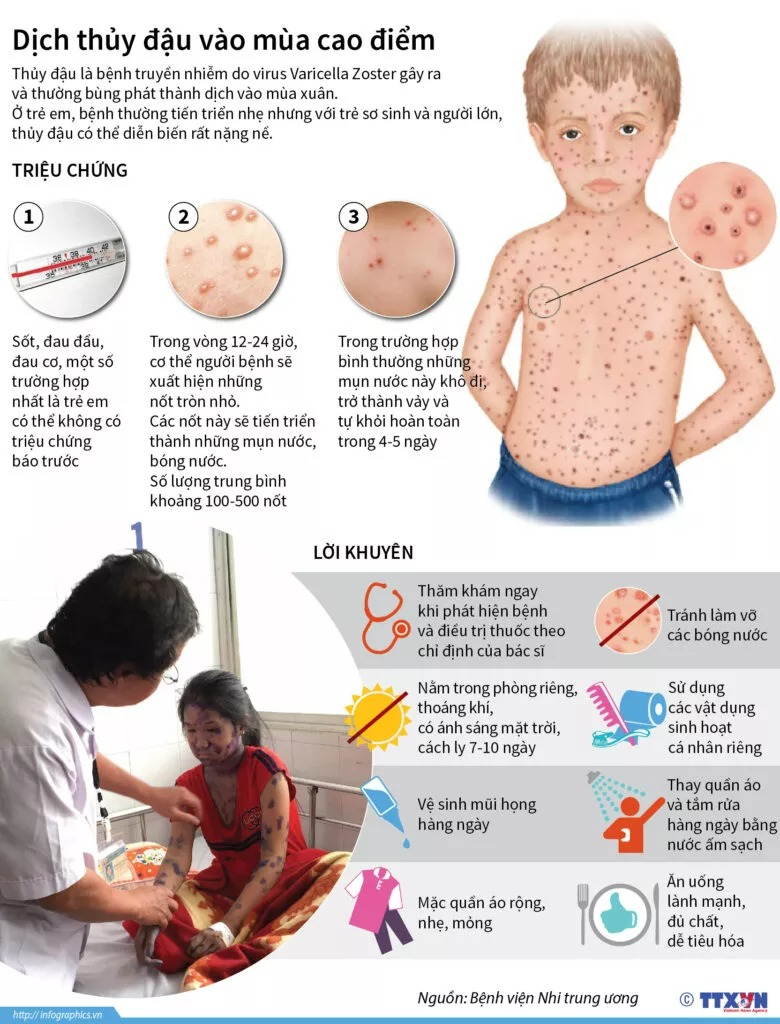 Mắc thủy đậu, bé 3 tuổi bị nhiều biến chứng, viêm phế quản, nhiễm khuẩn huyết - Ảnh 4.