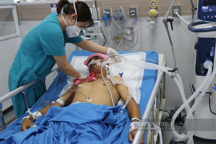 Ca Covid-19 ở Hà Nội bất ngờ tăng trở lại, nhiều bệnh nhân phải thở oxy có đáng lo ngại? - Ảnh 3.