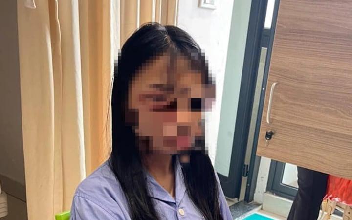 Nữ sinh lớp 8 ở Hà Nội bị đánh hội đồng: "Các em đang là bạn thân"