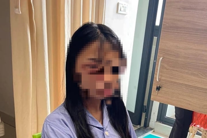 Đánh hội đồng nữ sinh lớp 8 phải nhập viện, 3 học sinh ở Hà Nội bị đình chỉ học - Ảnh 1.