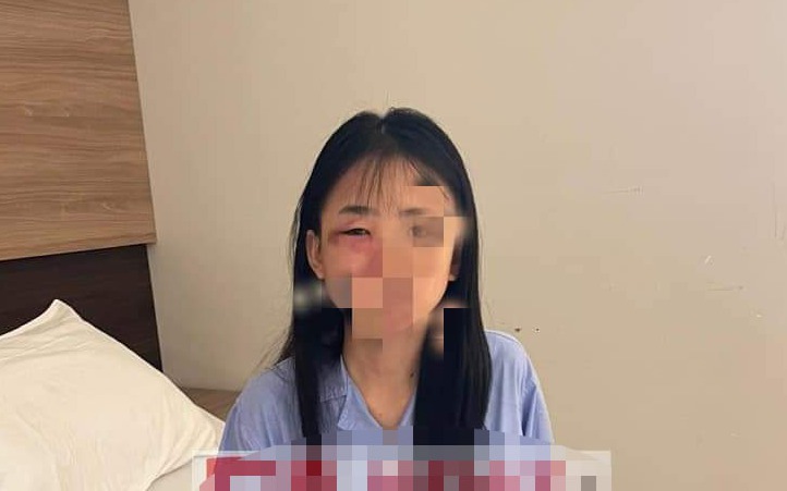 Nữ sinh lớp 8 bị đánh hội đồng ở Hà Nội: Chính quyền nhận định là vụ bạo lực học đường