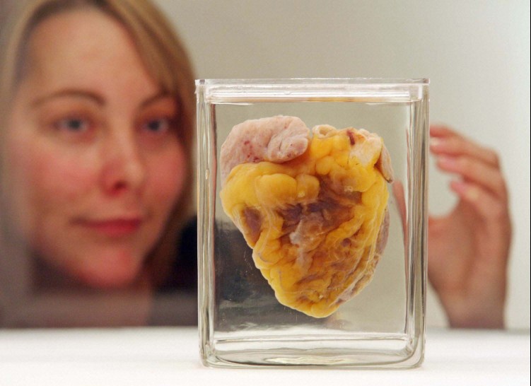 Người phụ nữ thấy trái tim mình trưng bày tại bảo tàng sau 16 năm - Ảnh 1.