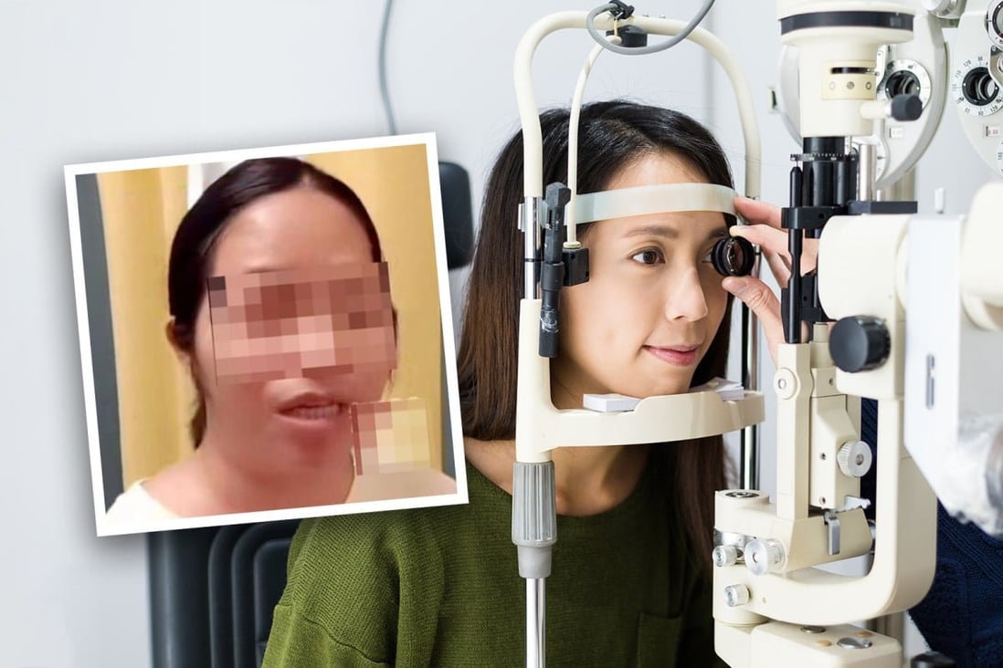 Trung Quốc: Không được chứng nhận khuyết tật vì chỉ mù một mắt - Ảnh 1.