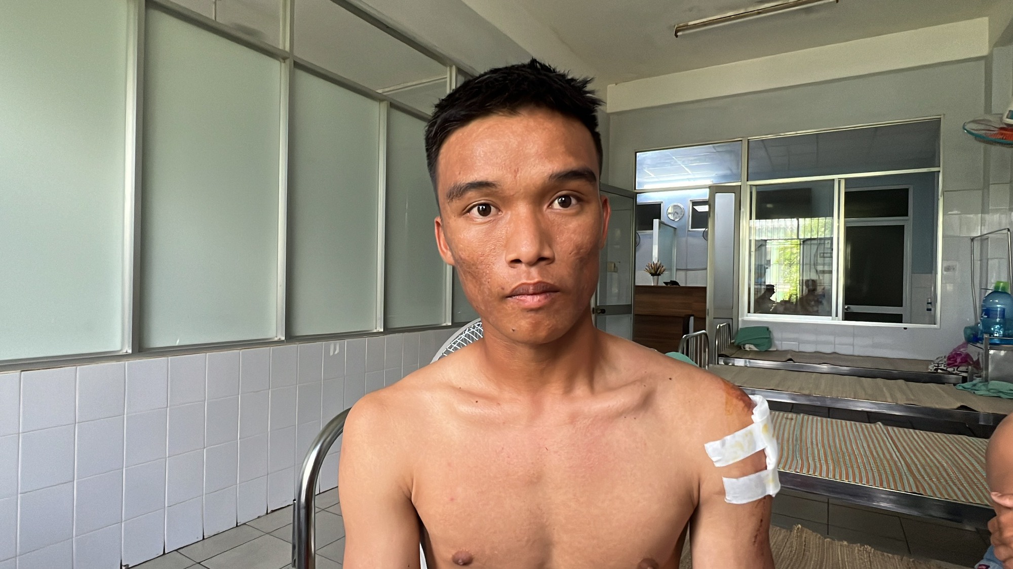 Cầu thủ Quảng Nam kể lại chuyến xe gặp nạn khi đang đổ đèo, mất thắng - Ảnh 3.