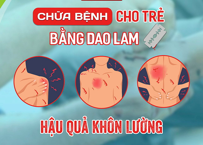 Bé trai 10 tuổi tử vong sau khi bị rạch dao lam trên người để thải độc - Ảnh 1.