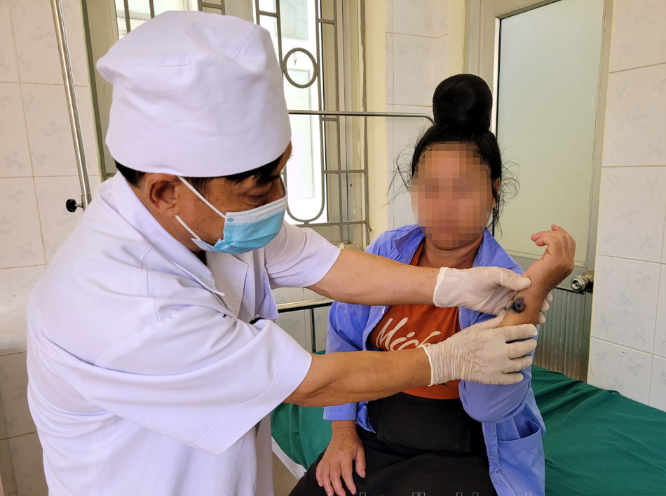 Đã có 14 người ở Hà Giang, Điện Biên mắc bệnh than lây từ trâu, bò, Cục Thú y đưa ra khuyến cáo - Ảnh 1.