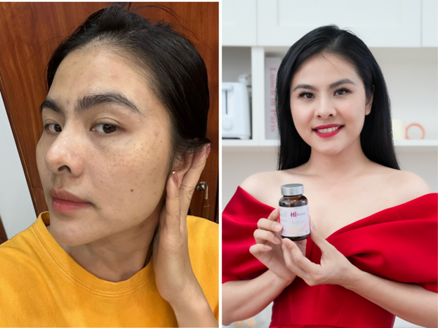 Diễn viên Vân Trang và mẹ ruột tin dùng Hi Beauty - Ảnh 1.