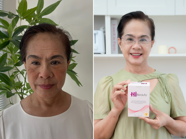 Diễn viên Vân Trang và mẹ ruột tin dùng Hi Beauty - Ảnh 3.
