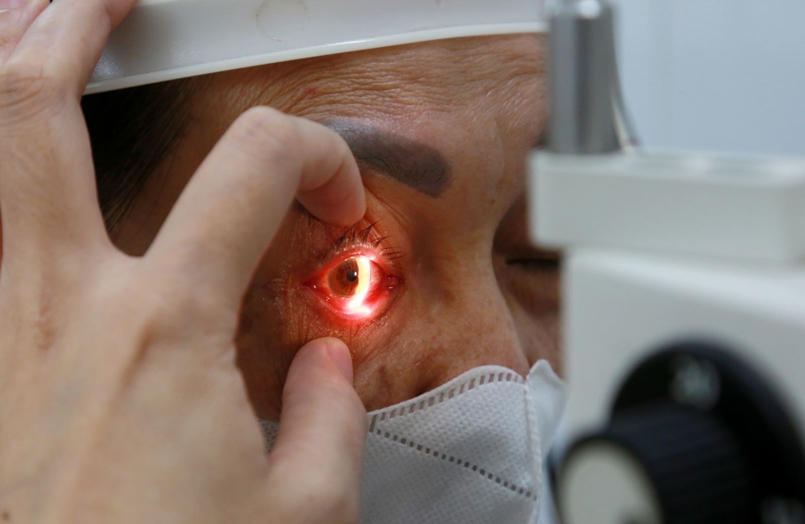 Dịch đau mắt đỏ lan rộng, Bộ Y tế khuyến cáo 5 biện pháp phòng chống - Ảnh 1.