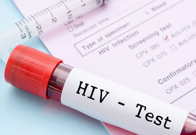 
Điều kiện xác định người bị nhiễm HIV do tai nạn rủi ro nghề nghiệp - Ảnh 1.