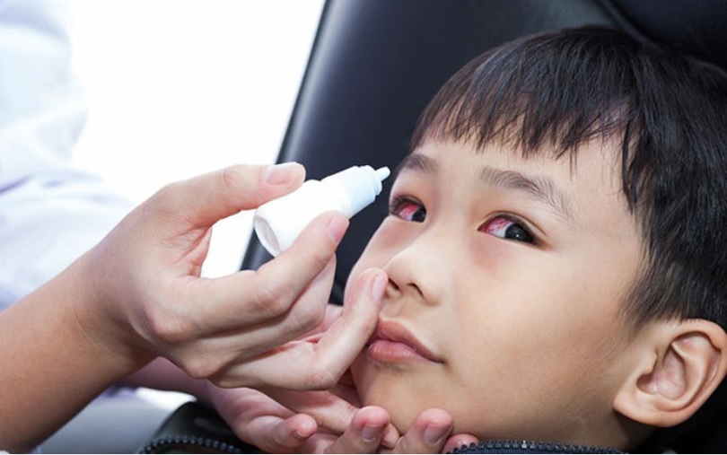 Xử nghiêm việc lợi dụng dịch đau mắt đỏ để đầu cơ, tăng giá thuốc - Ảnh 1.