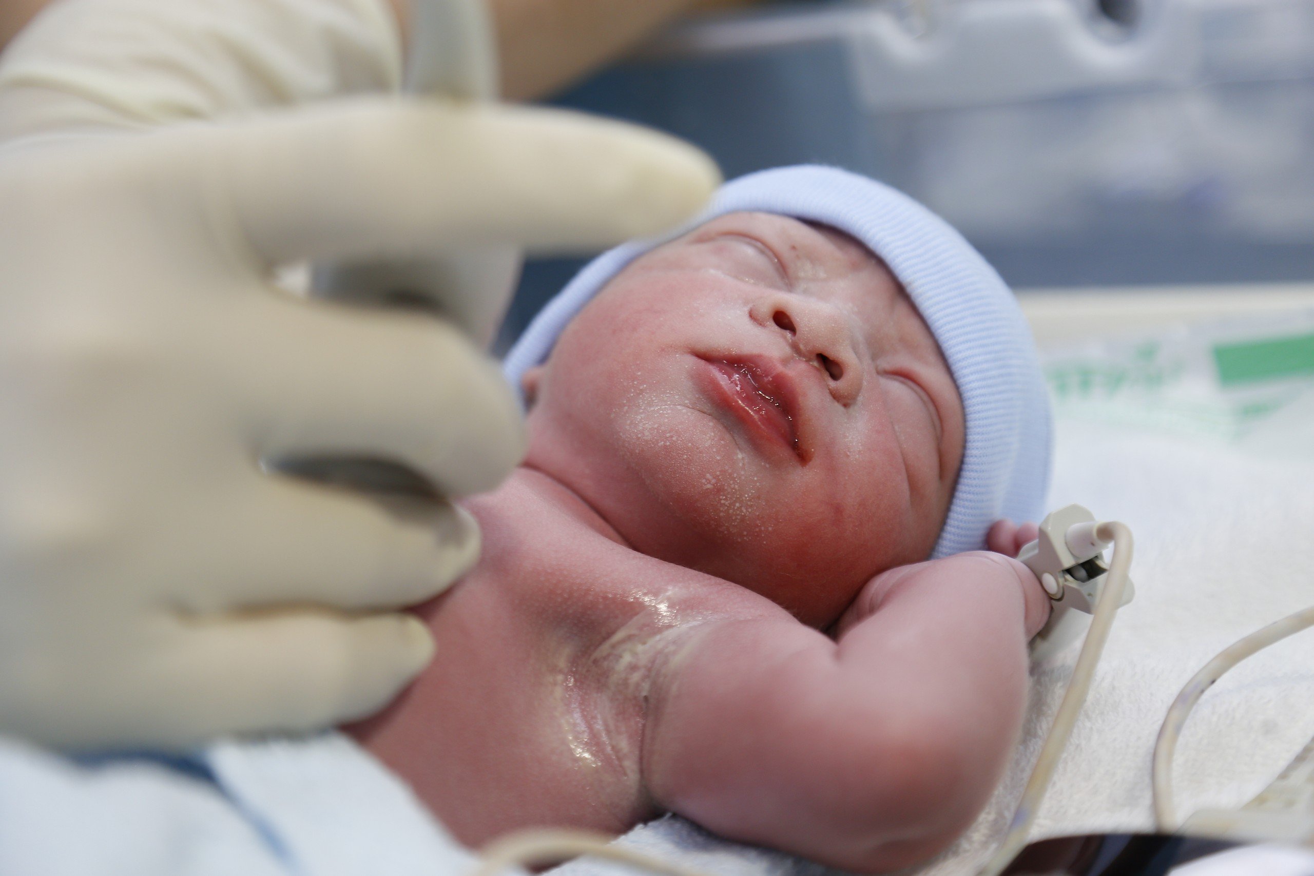 Kỳ tích: Em bé đầu tiên được thông tim can thiệp khi còn trong bào thai đã chào đời khỏe mạnh- Ảnh 2.