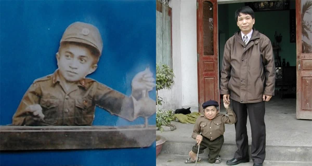 Việt Nam từng có người lùn nhất lịch sử nhân loại: 18 tuổi mới tập đi, suýt giành kỷ lục Guinness- Ảnh 1.
