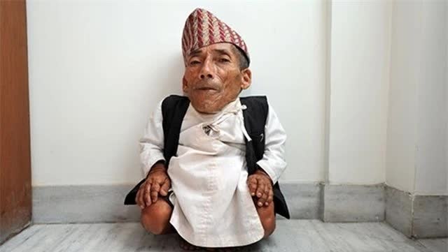 Việt Nam từng có người lùn nhất lịch sử nhân loại: 18 tuổi mới tập đi, suýt giành kỷ lục Guinness- Ảnh 2.