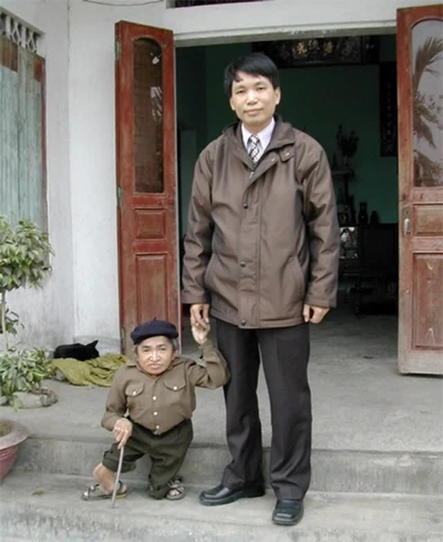 Việt Nam từng có người lùn nhất lịch sử nhân loại: 18 tuổi mới tập đi, suýt giành kỷ lục Guinness- Ảnh 3.