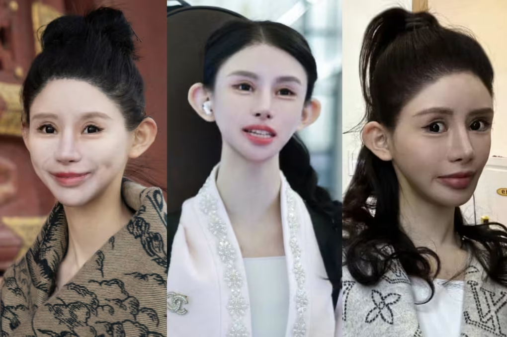 Nhan sắc khác lạ của hot girl Trung Quốc "nghiện" dao kéo từ năm 13 tuổi- Ảnh 3.