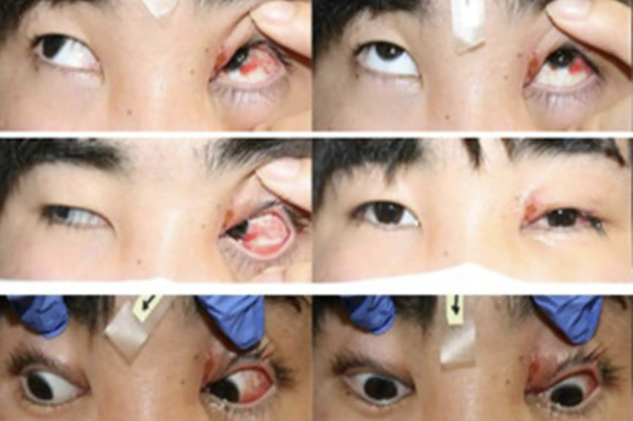 Chàng trai 19 tuổi mắc chứng rối loạn mắt hiếm gặp sau khi bị chó cắn- Ảnh 1.