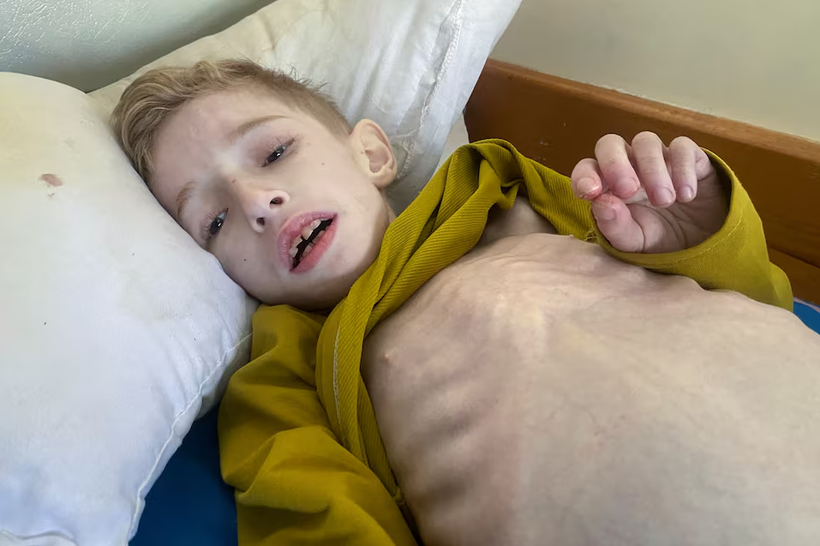 Trẻ em ngấp nghé chết đói tràn ngập bệnh viện Gaza giữa cảnh báo về 'ngày tận thế' nếu Israel tấn công Rafah- Ảnh 1.
