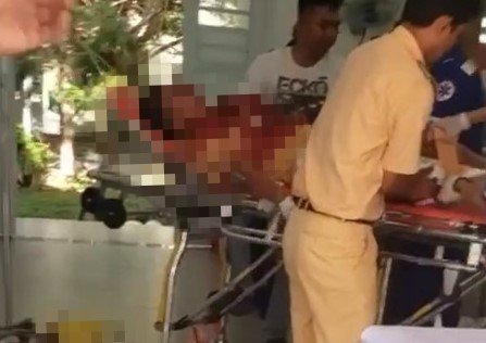 Một trung úy CSGT ở huyện Cần Giờ nhập viện trong tình trạng nguy kịch khi lái mô tô đặc chủng đụng hai người dân- Ảnh 1.