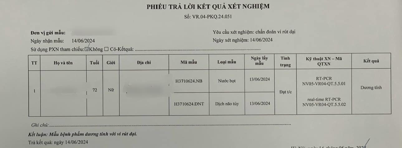 Cụ bà sợ nước, sợ gió, chân tay co cứng sau 2 tháng bị chó cắn- Ảnh 1.