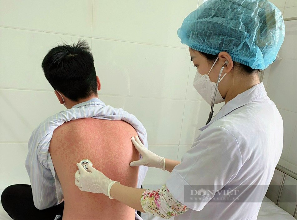 Số ca mắc bệnh sởi ở Nghệ An chưa có dấu hiệu dừng lại- Ảnh 1.