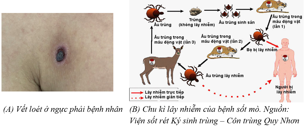 Sốc nhiễm khuẩn, suy đa tạng, nguy kịch vì 1 con vật bé tí ti- Ảnh 2.