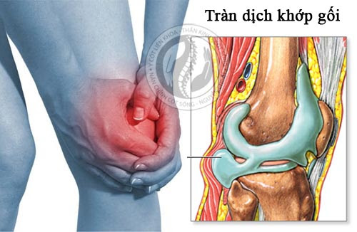 Ca sĩ Phương Linh tiết lộ lý do sức khỏe, căn bệnh cô mắc nguy hiểm thế nào?- Ảnh 2.