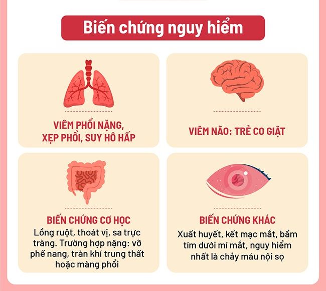 Bé 24 ngày tuổi tím tái vì ho do mắc bệnh "tưởng ít gặp"- Ảnh 3.