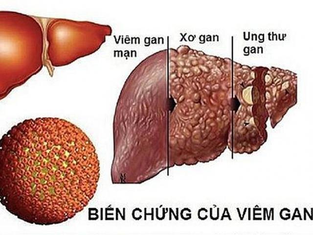 Giám đốc Bệnh viện K nói gì trước thông tin "mỗi lần đi xạ trị bệnh nhân ung thư mất 200.000 đồng”?- Ảnh 4.