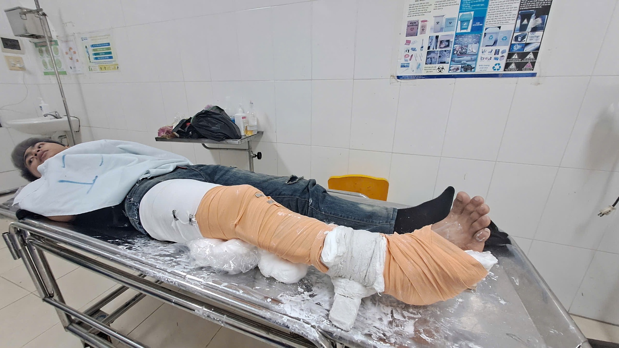 Các nạn nhân kể giây phút kinh hoàng khi xe khách bất ngờ lật nhào tại Phú Yên khiến 3 người chết- Ảnh 1.