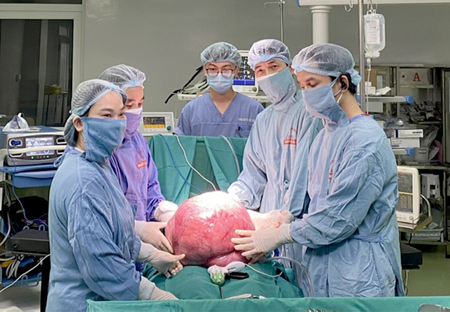 Kinh ngạc với khối u khổng lồ nặng 15kg trong bụng người phụ nữ- Ảnh 2.