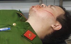 Đà Nẵng: Ngăn chặn đối tượng có tiền sử bệnh tâm thần dọa giết người, hai chiến sĩ công an bị chém 