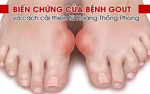 Biến chứng của bệnh gout và cách cải thiện từ Hoàng Thống Phong