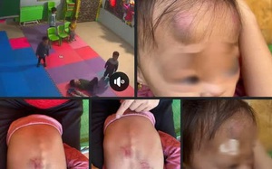 Vụ bé gái bị đánh ở Bắc Giang: UBND xã ra quyết định "nóng" với Trường mầm non Vân Vũ