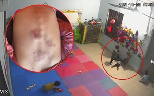 Vụ bé gái bị đánh ở Bắc Giang: Trường mầm non Vân Vũ từng để trẻ 1 tuổi bầm tím đầy người
