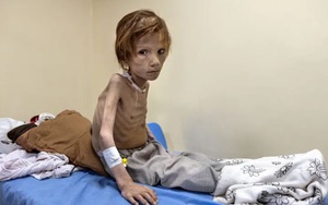 Những hình ảnh 'nhói lòng' trong cuộc khủng hoảng lương thực ở Afghanistan
