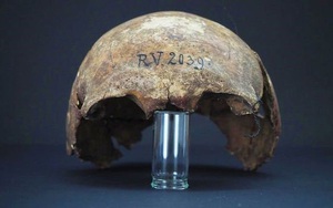 Phát hiện hộp sọ 5.000 năm tuổi của người đầu tiên từng nhiễm bệnh dịch hạch 