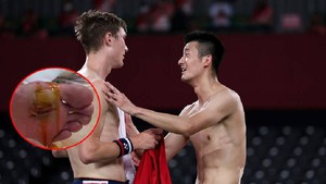 Olympic 2020: Chen Long mất ngôi vương cầu lông vì bàn chân tứa máu