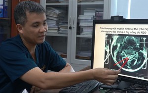 Chơi "bóng cười" nhập viện: Tiết lộ đáng sợ từ Trung tâm Chống độc Bệnh viện Bạch Mai