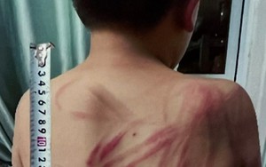 Vụ bố bạo hành con đẻ ở Đà Lạt: Tạm giam người bố 3 tháng